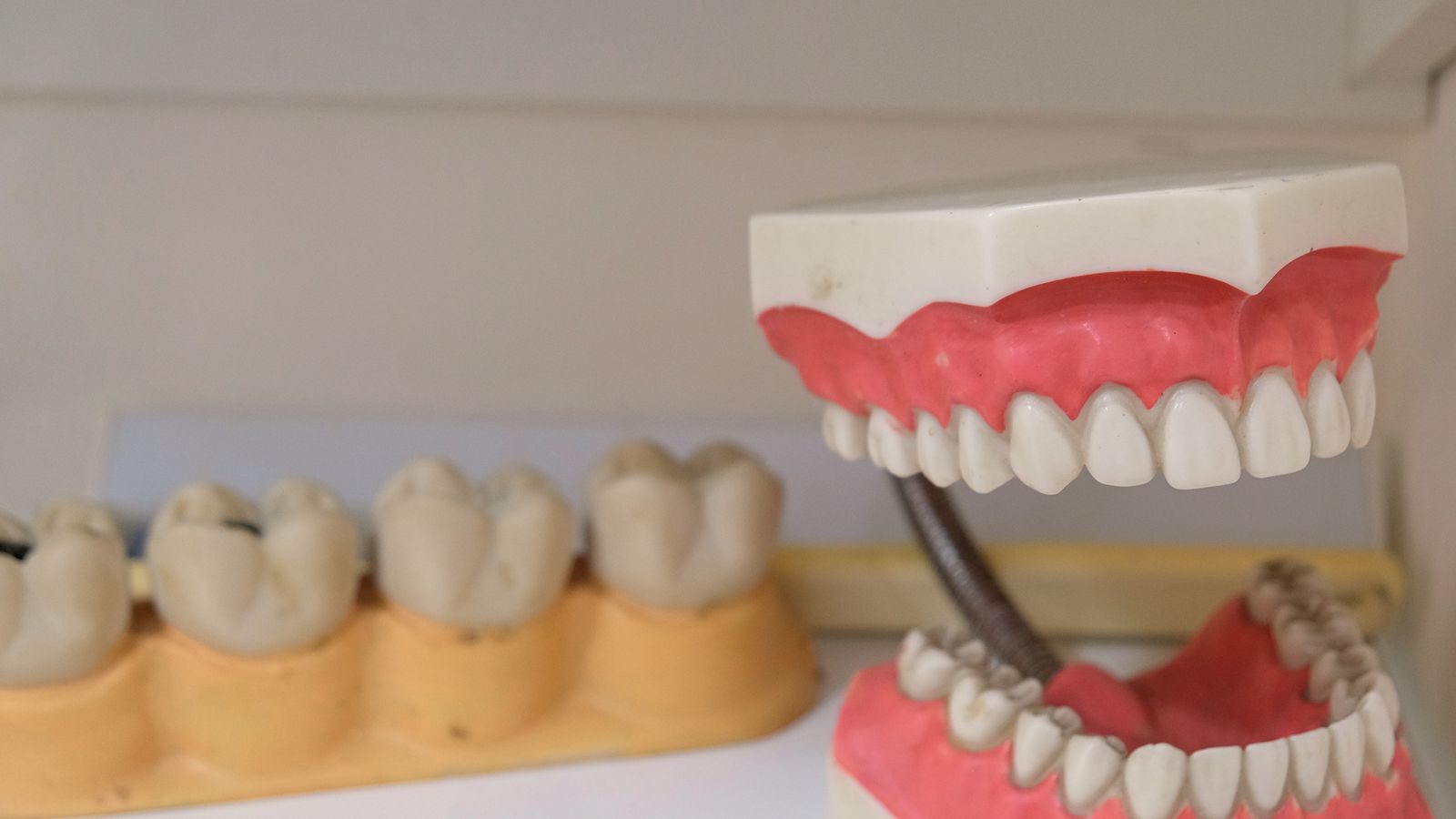Răng sứ Zirconia và Cercon: so sánh để chọn đúng